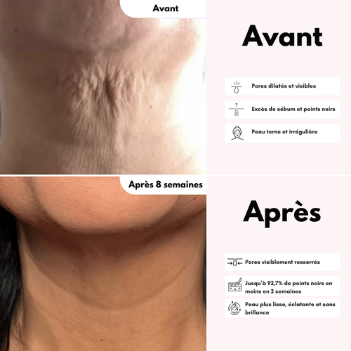 Crème Contour des Yeux