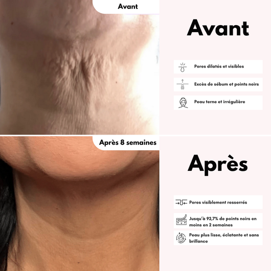 La Crème Cou & Décolleté