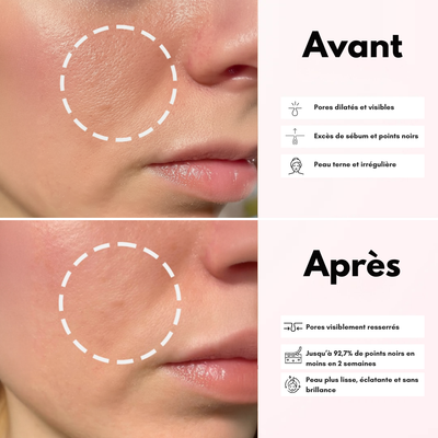 Sérum Purifiant au Riz Blanc