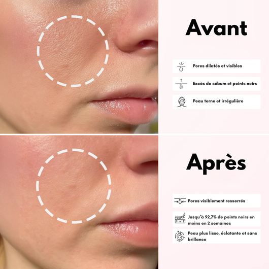 Sérum Purifiant au Riz Blanc