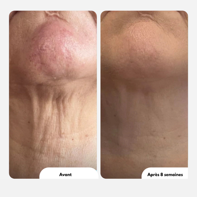 La Crème Cou & Décolleté