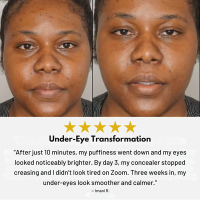 Lylara - Avocado Eye Mask