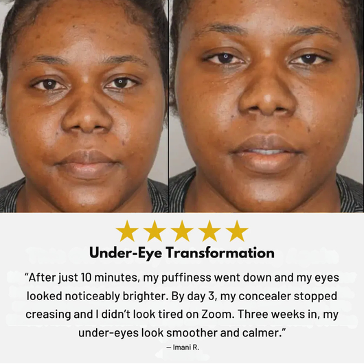 Lylara - Avocado Eye Mask