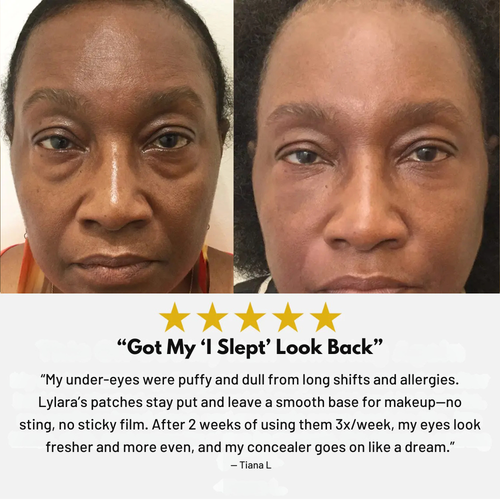 Lylara - Avocado Eye Mask